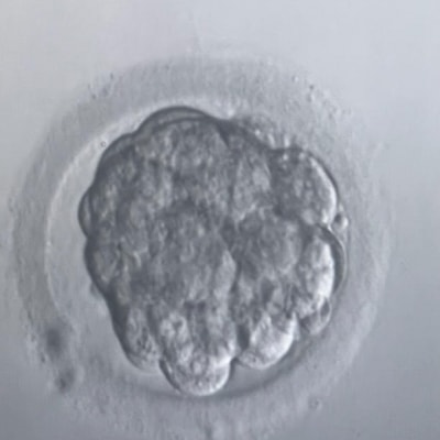 Na onze eerste IVF punctie kregen we slecht nieuws