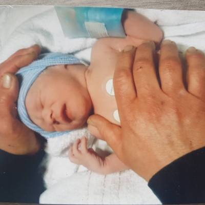 Mijn baby groeide onvoldoende vanaf 20 weken zwangerschap